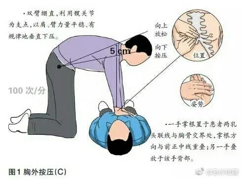 最新版心肺复苏步骤详解解析